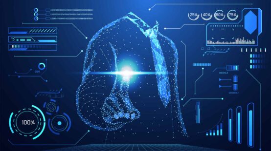 Is your business intelligent? Blog by TSG